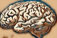 Bệnh loạn dưỡng chất trắng não: Các thể bệnh và triệu chứng